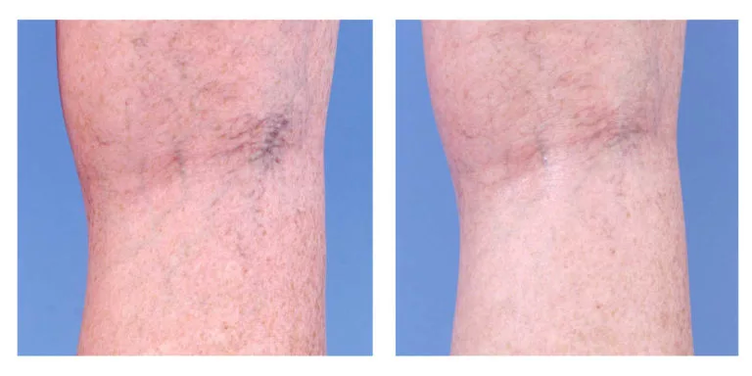 Kozmetická korekcia